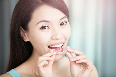 woman putting her Invisalign clear braces in her mouth